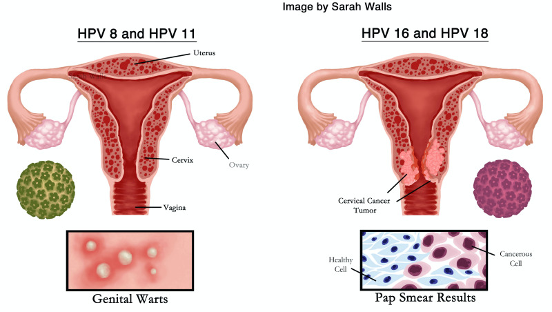 175275-Thumbnail Image.jpg