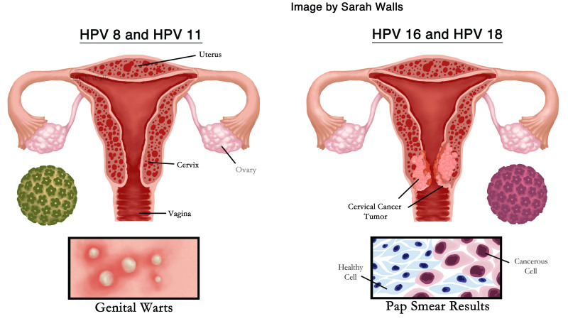 175276-Thumbnail Image.jpg